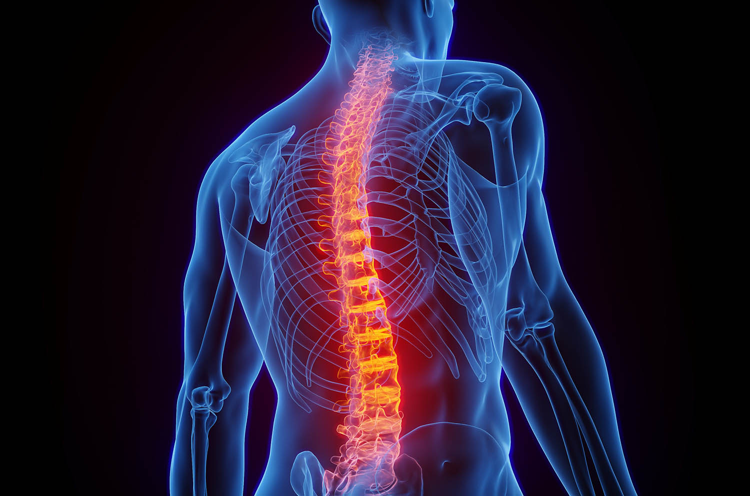 Living With Chronic Back Pain-